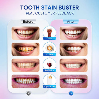 Bright Smile Whitening Toothpaste