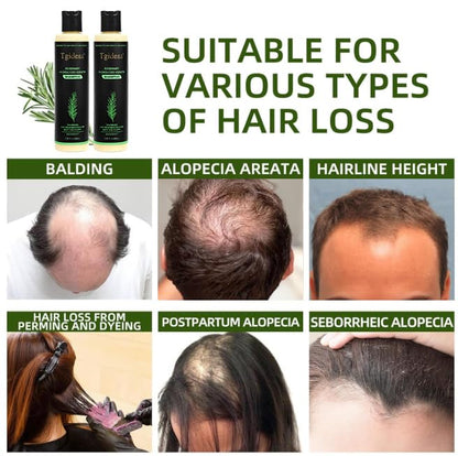 Rosemary Biotin Volumizing Shampoo
