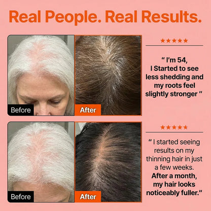 Hair Growth Serum with Massage Brush Applicator – Thickening &amp; Hair Regrowth Scalp Treatment