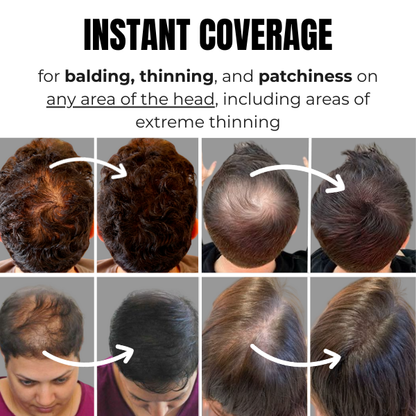 Rooty 2.0 – Hair Destiny Filler