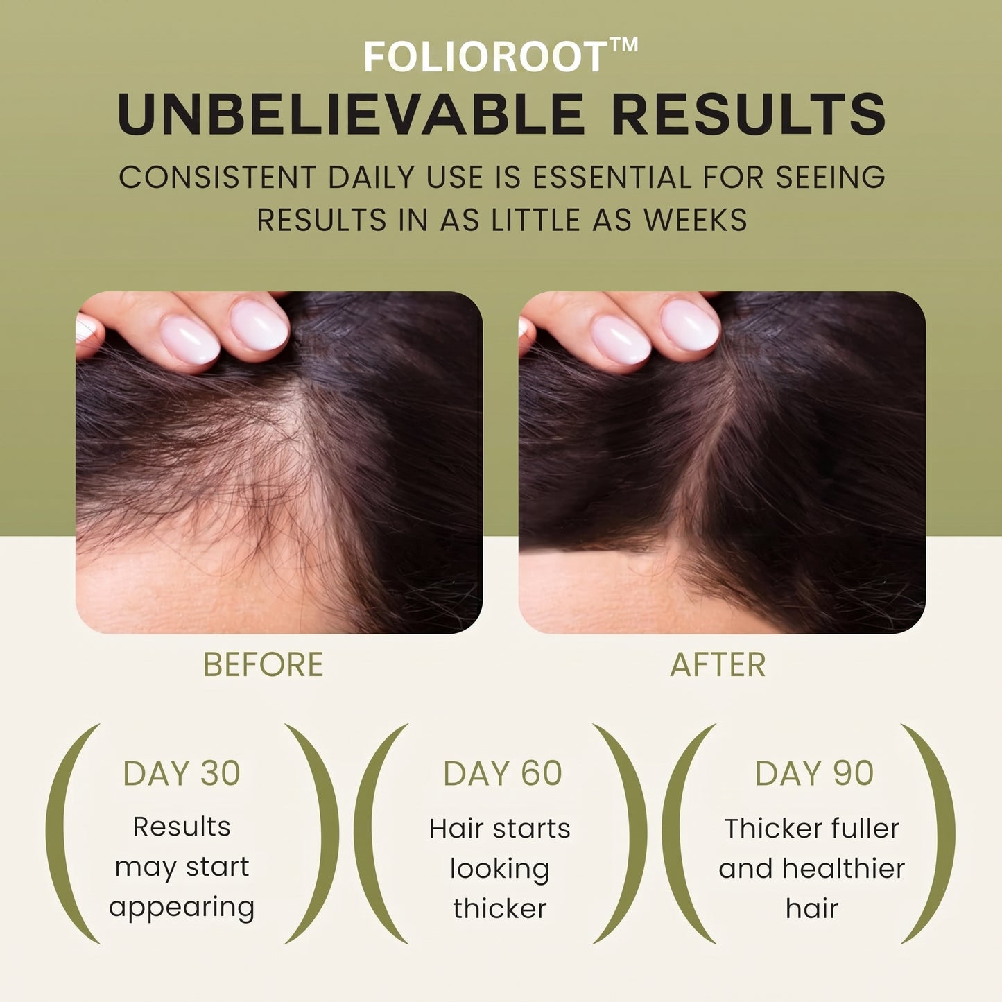 FolioRoot™ Hair Activator Oil