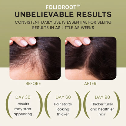 FolioRoot™ Hair Activator Oil